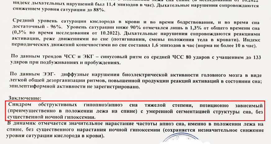 Пример из практики. Лечение тяжелой формы апноэ без удаления аденоидов